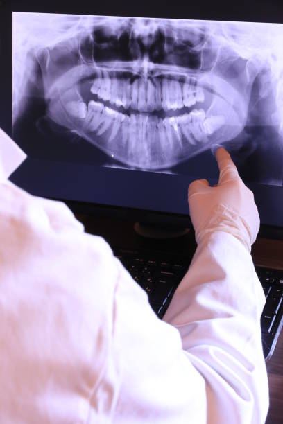 Best Knocked-Out Tooth Emergency  in Holliday, TX
